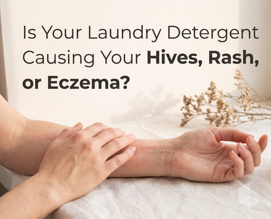 Is Your Laundry Detergent Causing Your Hives, Rash, or Eczema?